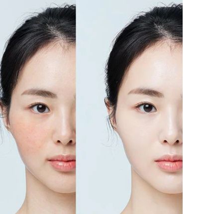 Luxiface Skin Analyser App: Tested and Approved by Experts