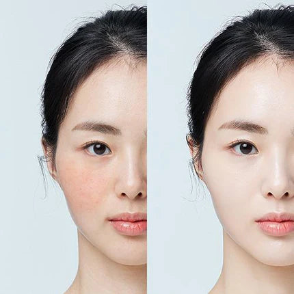 Rosacea Friendly Korean skincare products at Luxiface