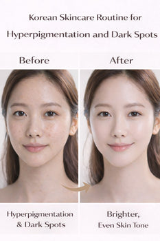 K-Beauty Ingredients for Hyperpigmentation: What Actually Helps Fade Dark Spots Without Irritating Your Skin