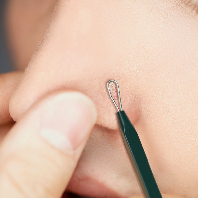 [PyunkangYul] Pimple Extractor