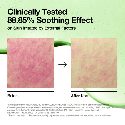 [Anua] Azelaic 10 Hyaluron Redness Soothing Pad 230ml 90ea-Luxiface.com