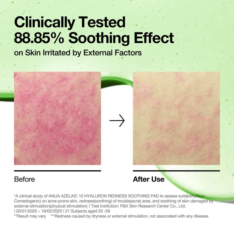 [Anua] Azelaic 10 Hyaluron Redness Soothing Pad 230ml 90ea-Luxiface.com