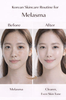 Korean Skincare Routine for Melasma - Lightweight