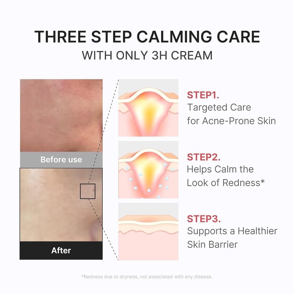 [Medicube] Hypochlorous 3H Relief Cream 50ml image 6