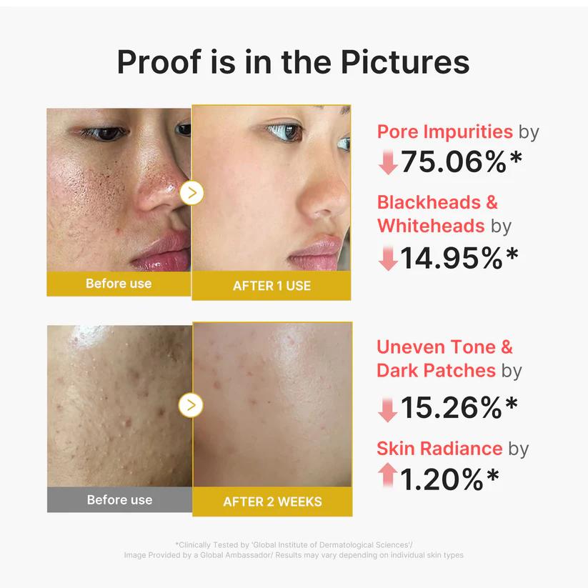 [Medicube] Kojic Acid Turmeric Peel Shot 80ml image 4
