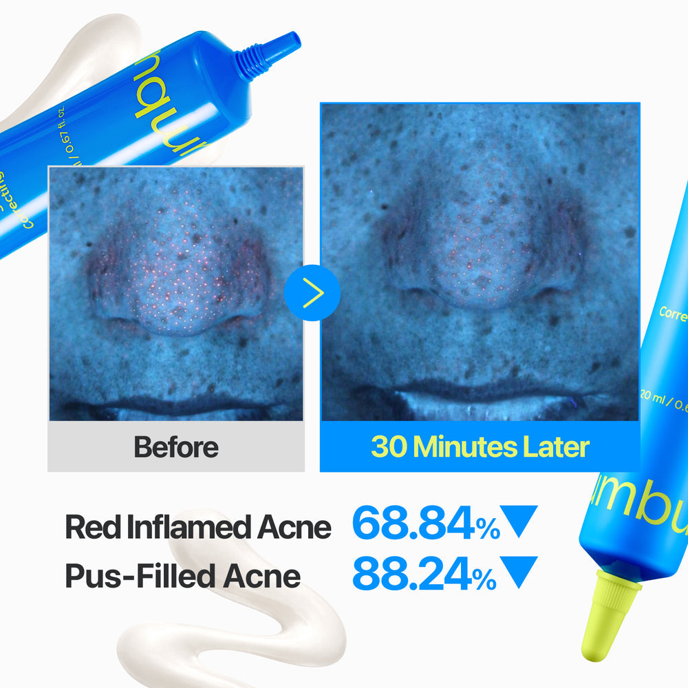[numbuzin] Zero Blemish 3X Spot Correcting Cream 20ml image 5