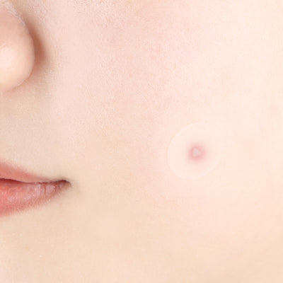 [PyunkangYul] Clear Spot Patch 72ea-Luxiface.com